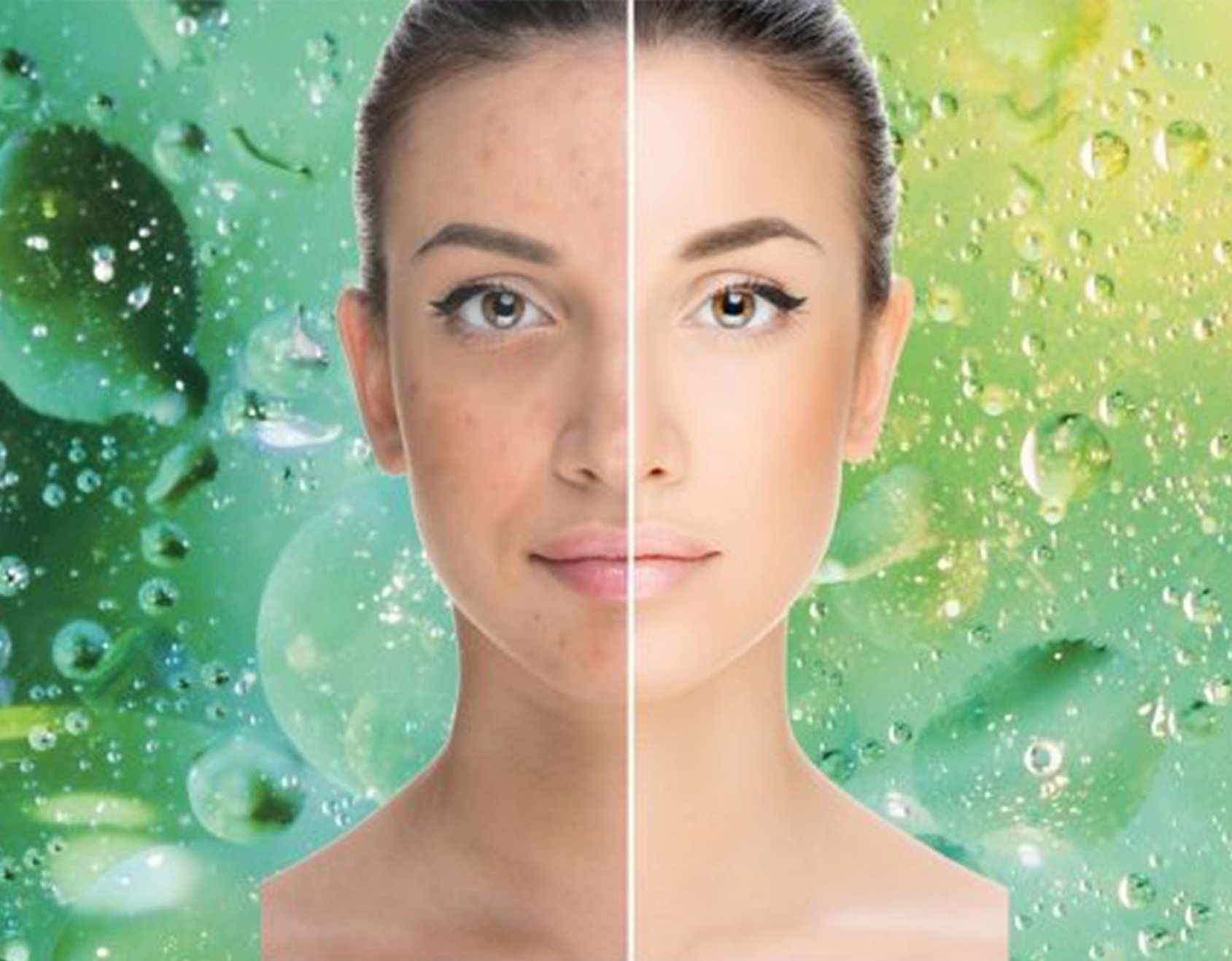 Green Peel Bio Microneedling