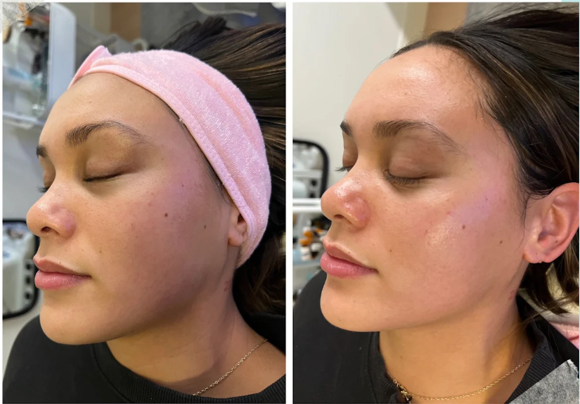 Lash extensions before and after results